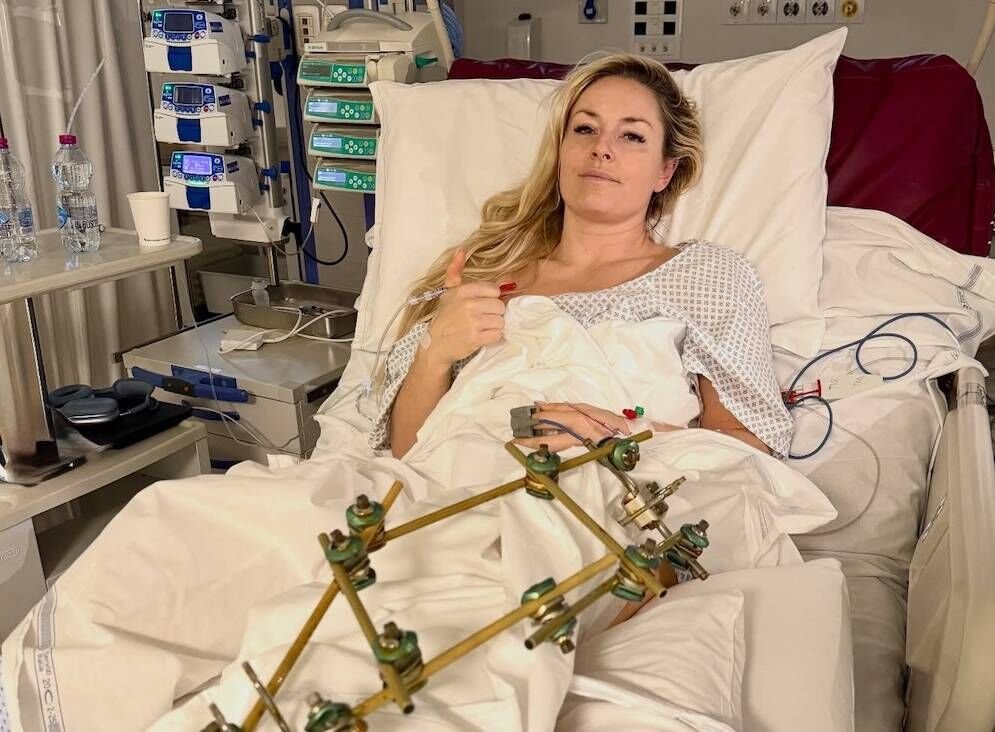 Lindsey Vonn di rumah sakit setelah operasi