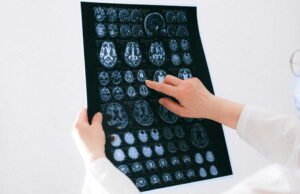 Meningitis: satu kematian tercatat di pusat pemrosesan ulang nuklir di La Hague