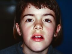 Julie Botet dalam “Kisah Darah Getah Bening 9424”