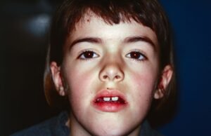 Julie Botet dalam “Kisah Darah Getah Bening 9424”