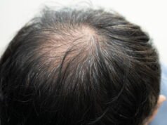 mengapa sekarang lebih sulit mendapatkan pengobatan