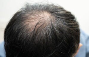 mengapa sekarang lebih sulit mendapatkan pengobatan